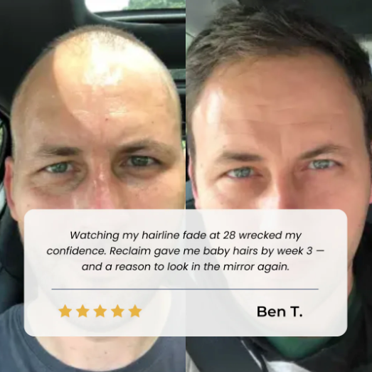 Vakkav Hair Growth Roll on Serum