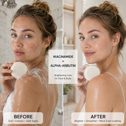 Niacinamide Brightening Soap – Dark Spot & Uneven Skin Tone Care
