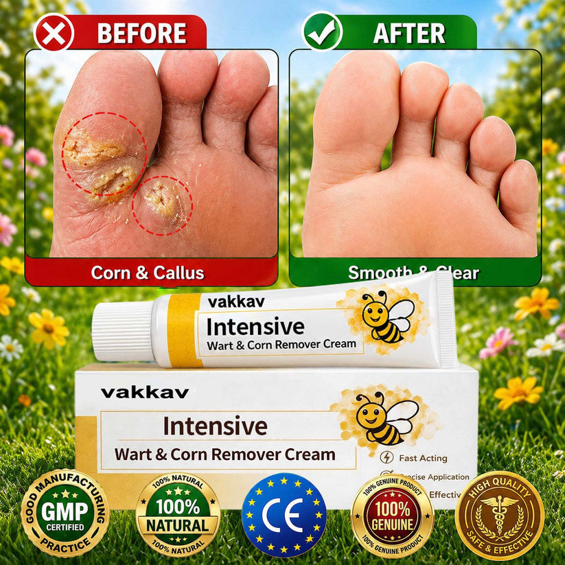 VAKKAV Intensive Wart and Corn Remover Cream