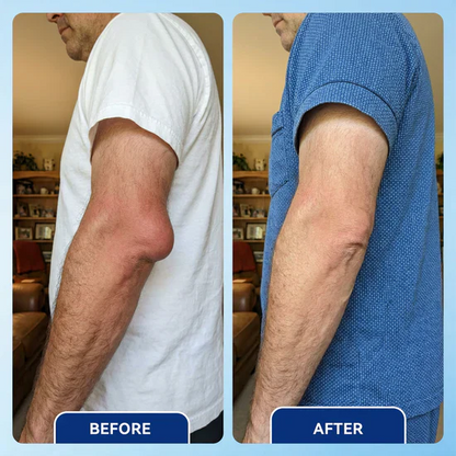 Vakkav™ Advanced Arthritis Relief Gel