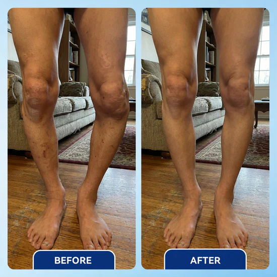 Vakkav™ Advanced Arthritis Relief Gel