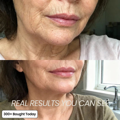 Up to 72% OFF vakkav PDRN Pink Collagen Volume Multi Balm