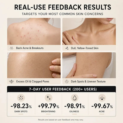Niacinamide Brightening Soap – Dark Spot & Uneven Skin Tone Care