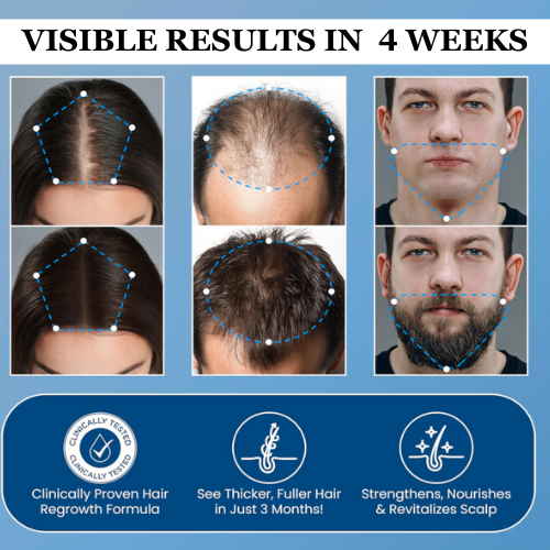 Vakkav Hair Growth Roll on Serum