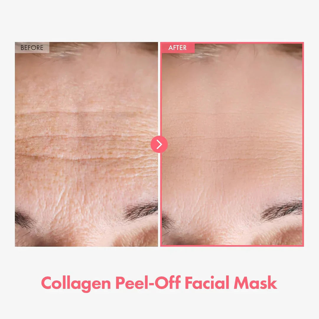 💥Limited Time Sales - 50% OFF💥Arbutin 7% + Tranexamic Acid 4% Cream