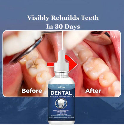 VAKKAV™ Advanced Enamel Repair & Whitening Kit (Includes Free LED Mirror)